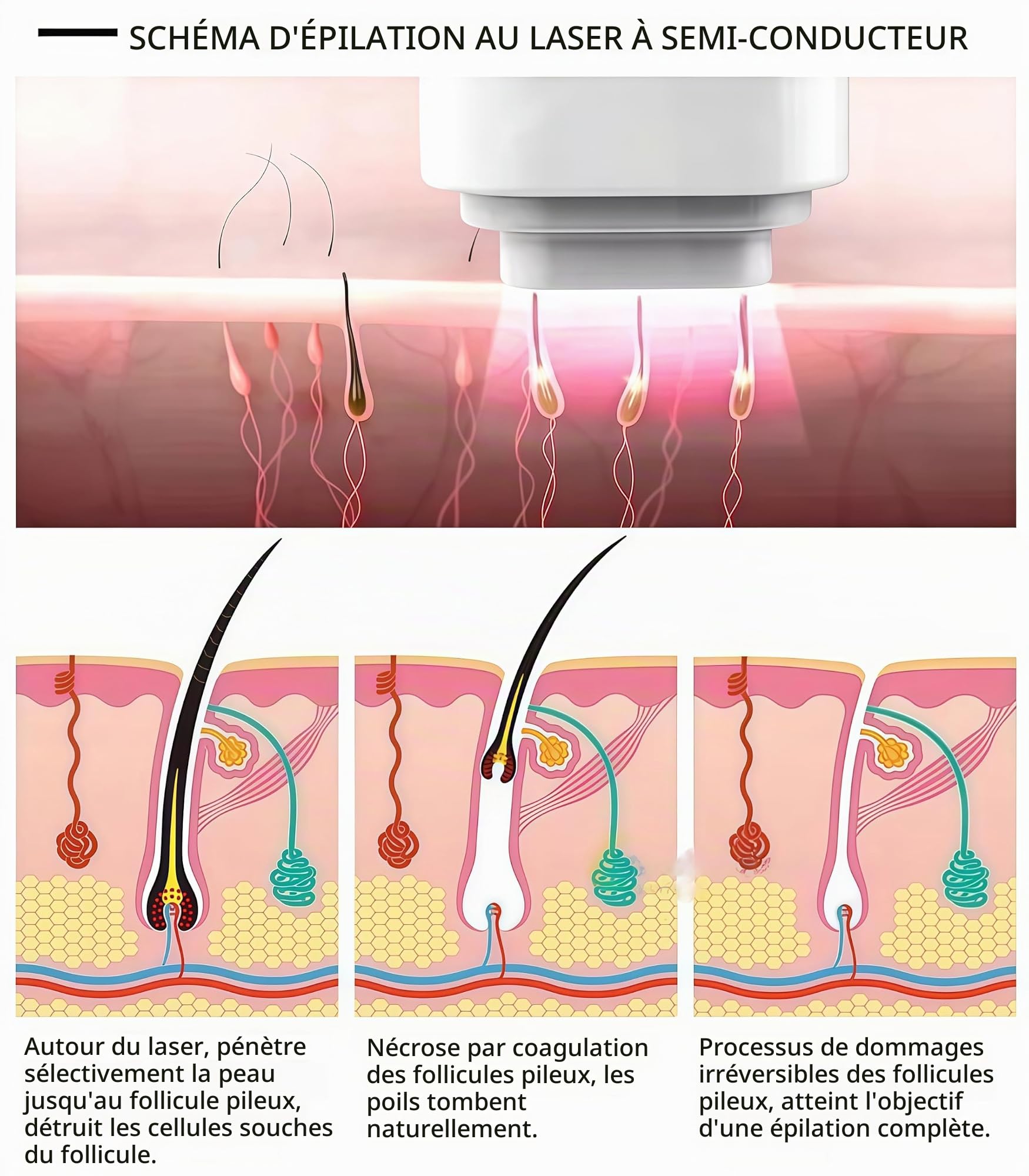 Appareil professionnel d'épilation laser diode 808 nm, 3 longueurs d'onde, refroidissement par point de glace, épilation définitive du visage et du corps, certifié CE.