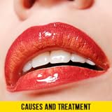 tonsillitis dauer [+] Bad Smell From Nose How To Remove Tonsil Stones