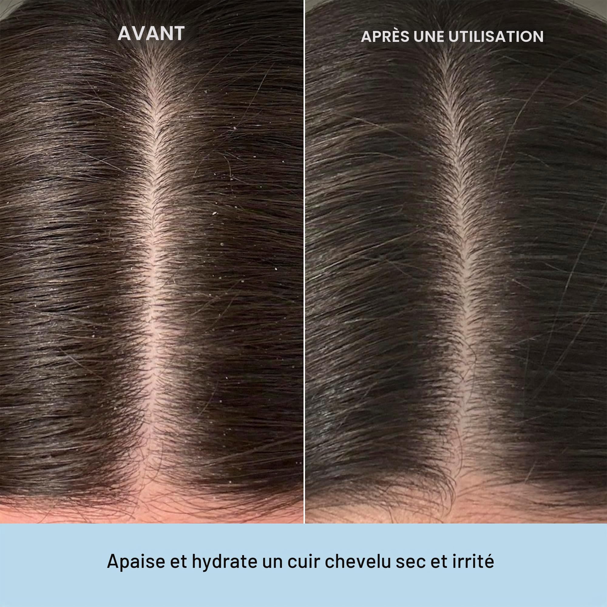 Briogeo Scalp Revival Huile de pré-lavage au romarin pour cheveux et cuir chevelu, 100 ml