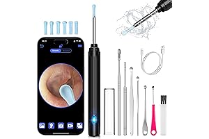 Advanced Ear Wax Removal Tool with Camera: The Ultimate Ear Cleaning Experience
