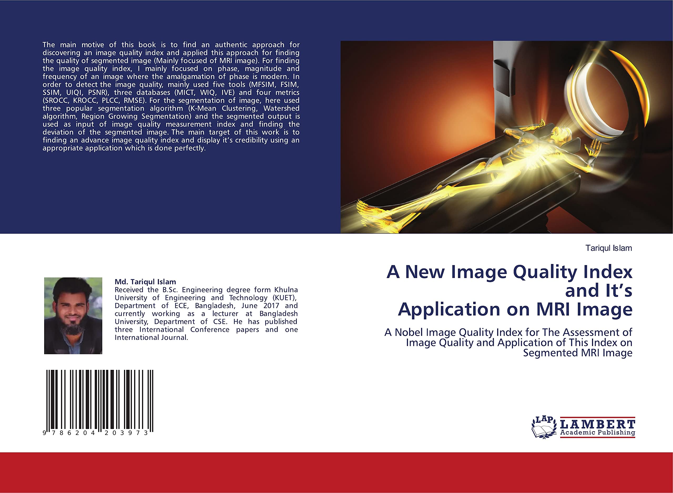 Buy A New Image Quality Index and It’s Application on MRI Image A