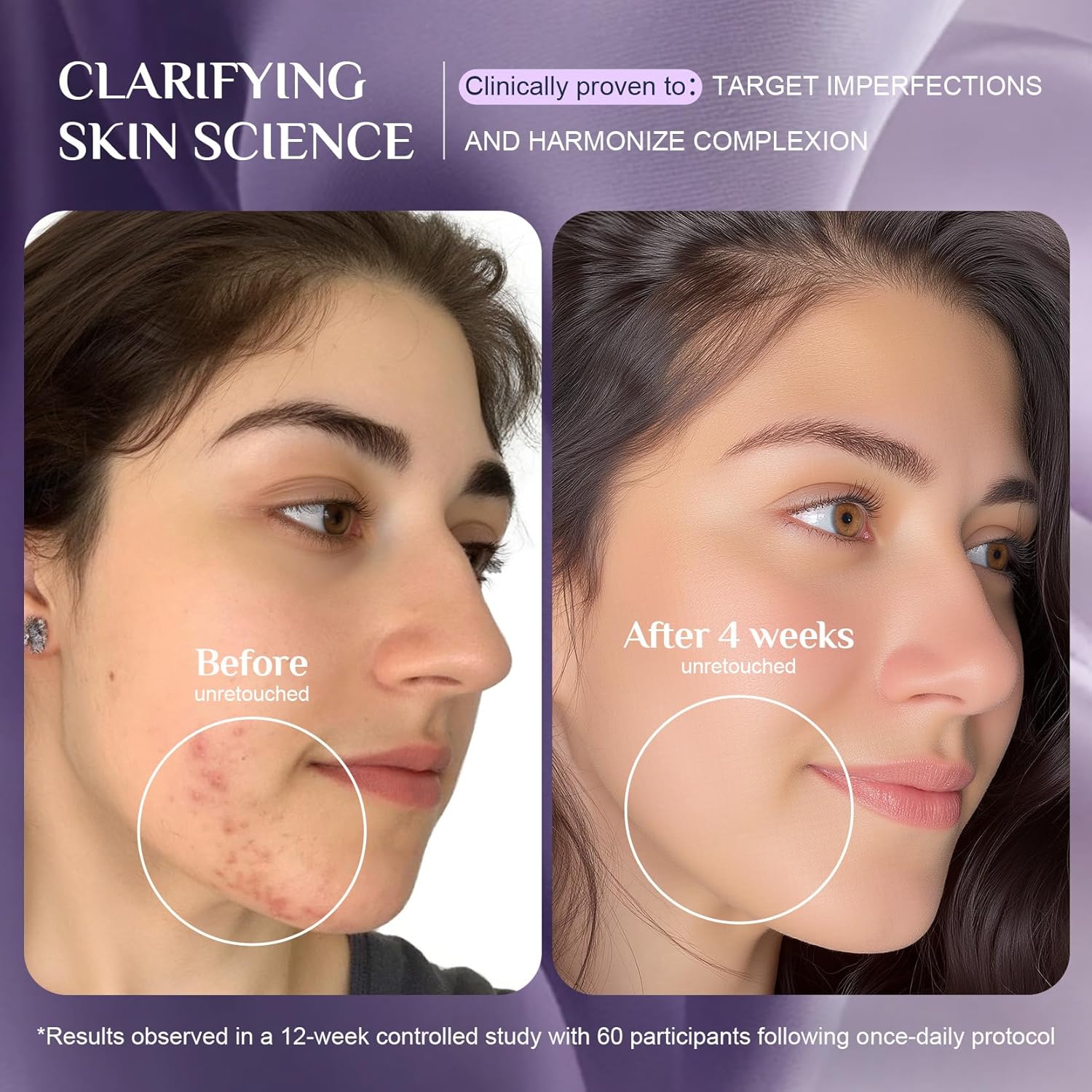 LED Light Therapy Mask Skin Care Mask,LED Red LED Red 630±5nm & NIR 830nm Wavelength for Home Use - Image 6