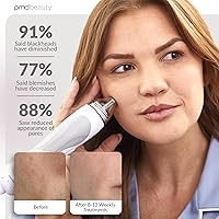 Vista 32 de PMD Personal Microderm Pro - At-Home Microdermabrasion Machine with Kit for Face & Body Exfoliating Crystals and Vacuum Suction for Fresh, Radiant