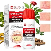 50 ml Eczema Lotion for Body Moisturising Cream Repair Cream Soothes and Nourishes Ideal for Rough and Dry Skin Care