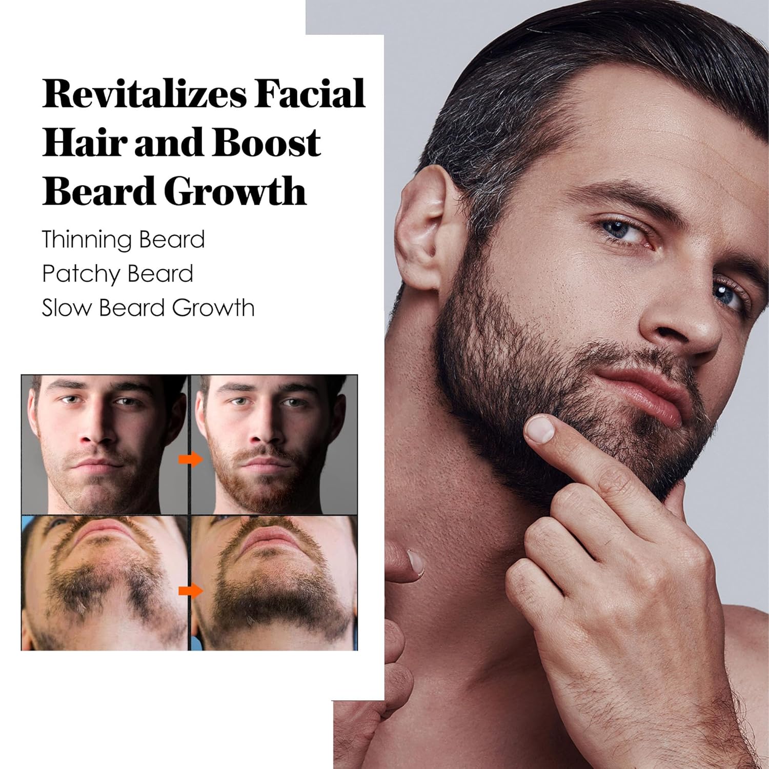 Minoxidil Beard Growth Oil: Minoxidil For Men Beard Infused With Biotin, Extra Strength Minoxidil 5% Beard Growth Serum to Grow Beard & Mustache Fast - Image 3