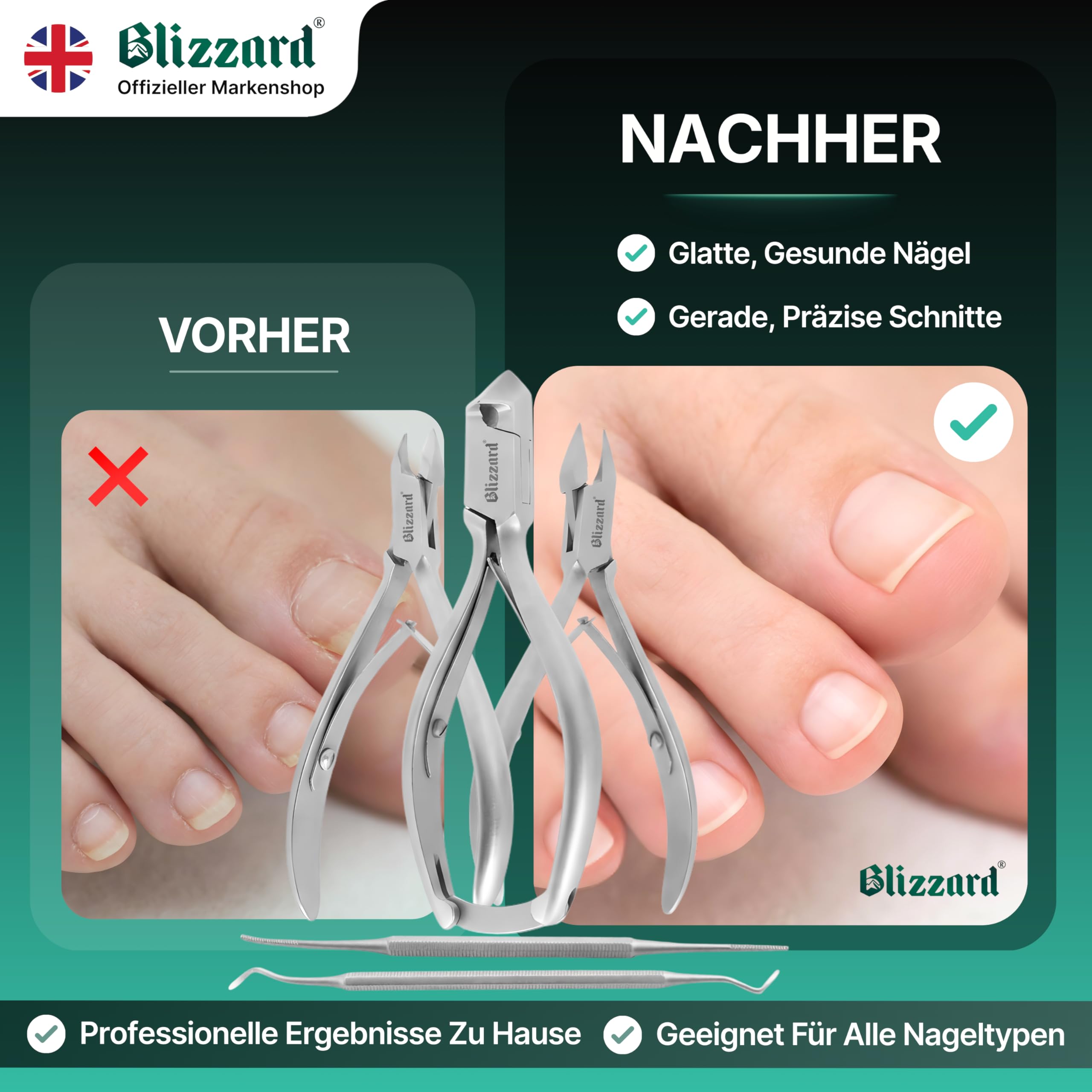 Blizzard Podologie Instrumente Set – 5-teiliges Fußpflege Set für harte & eingewachsene Nägel – Nagelzange, Eckenzange, Nagelhautentferner, Eckenfeile & Eckenheber – Profi Podologie Werkzeug