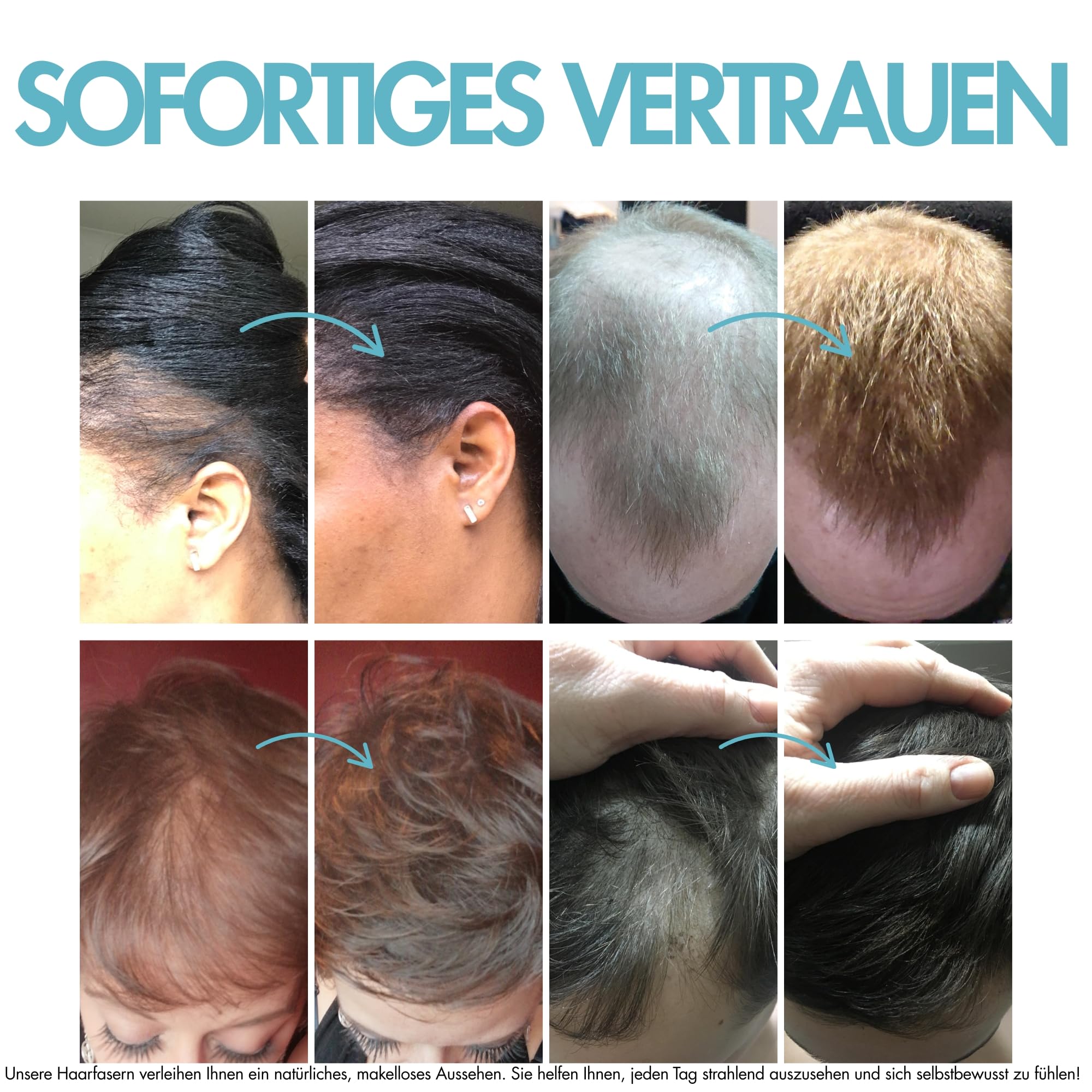 Hair Genetics Streuhaar Nachfüllpackung Für Natürliche Haarverdichtung - Haarpuder Männer Und Frauen Bei Haarausfall, Geeignet Für Dünnes Haar, Graue Ansätze, Wasserfest (Dunkelbraun, 50g)