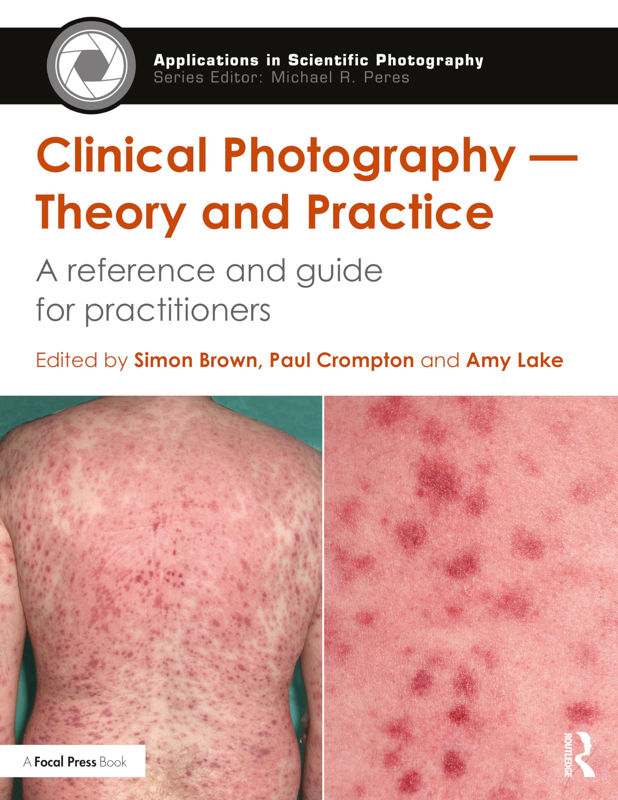 Clinical Photography ― Theory and Practice: A Reference and Guide for Practitioners