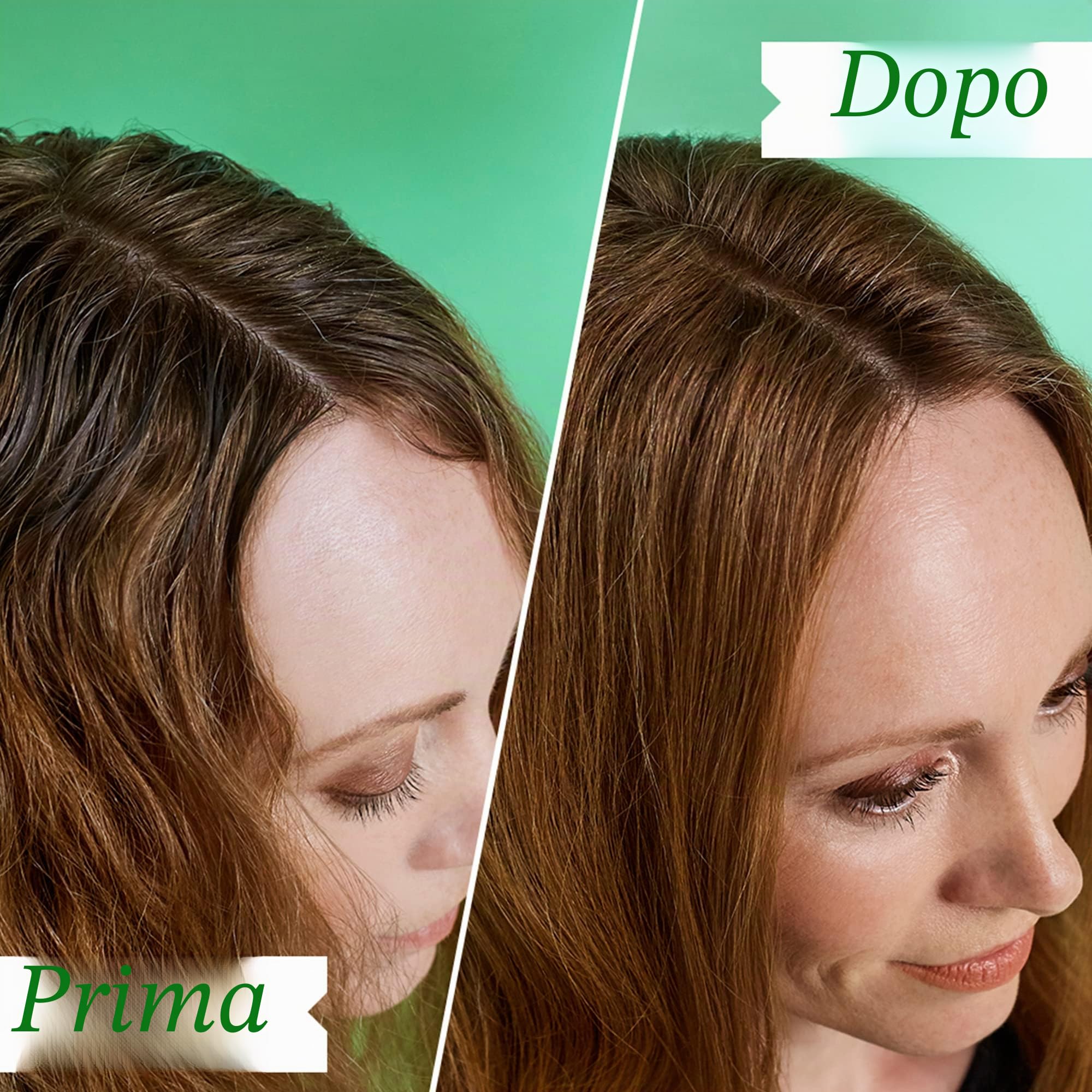 Philip Kingsley | Shampoo per il cuoio capelluto traballante/pruriginoso | Shampoo antiforfora per cuoio capelluto squamoso, pruriginoso, secco e grasso | 1000ml