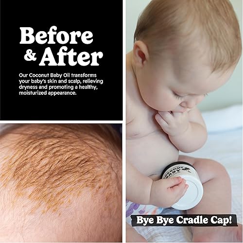 Miniatura 5 de Aceite de coco para bebé para cabello y piel hidratante orgánico totalmente natural masaje - piel sensible cuero cabelludo infantil grueso cabello