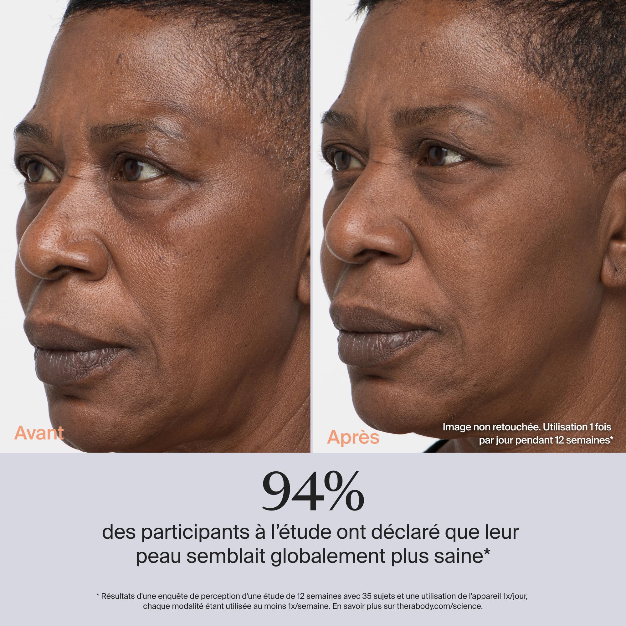 TheraFace PRO - Appareil de massage facial portable - Thérapie électrique pour le visage et les soins de la peau - Traitement 8 en 1 avec anneaux de thérapie par microcourant et lumière LED - Blanc