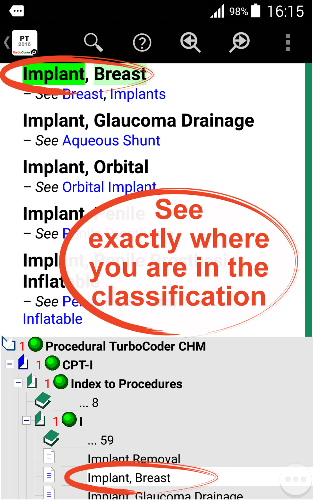 Aplicación Procedural TurboCoder CPT Codes & HCPCS TurboSearch (2016 ...