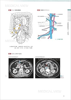 リンパ節郭清手技を究める[下部消化管編]［Web動画付］ (新DS NOW 13