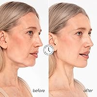 Vista 4 de MAREE Máscara de elevación de línea V con oro de 24 quilates, mascarilla facial de colágeno profundo para mujeres, máscara moldeadora de mandíbula