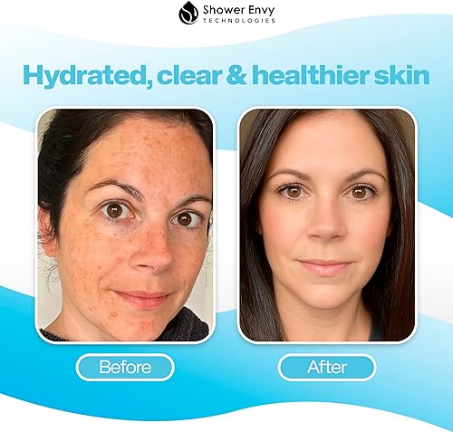 Miniatura 4 de ShowerEnvy Pure X - Cabezal de ducha de mano filtrado, alta presión, múltiples modos de pulverización, interruptor de encendidoapagado, purificador