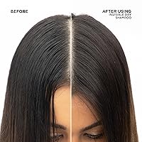 Vista 3 de Redken Champú seco invisible Para todo tipo de cabello Ligero y sin residuos Sin fragancia 3.1 onzas