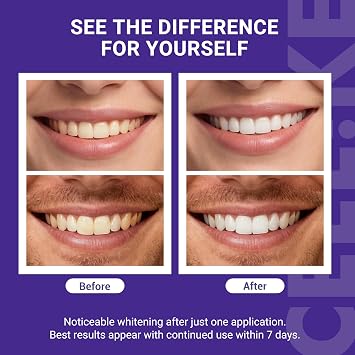 Purple Teeth Brightening Strips, 14 Strips (7 Treatments) – Pap + nHAP Enamel Care Formula, Purple Brightening Strips for a Cleaner-Looking Smile, Suitable for Sensitive Teeth