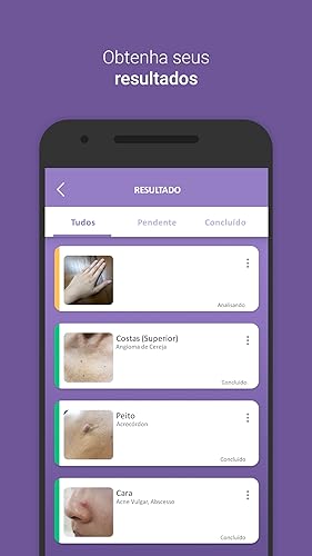 Medgic - Digitalize, analise e detecte problemas da pele
