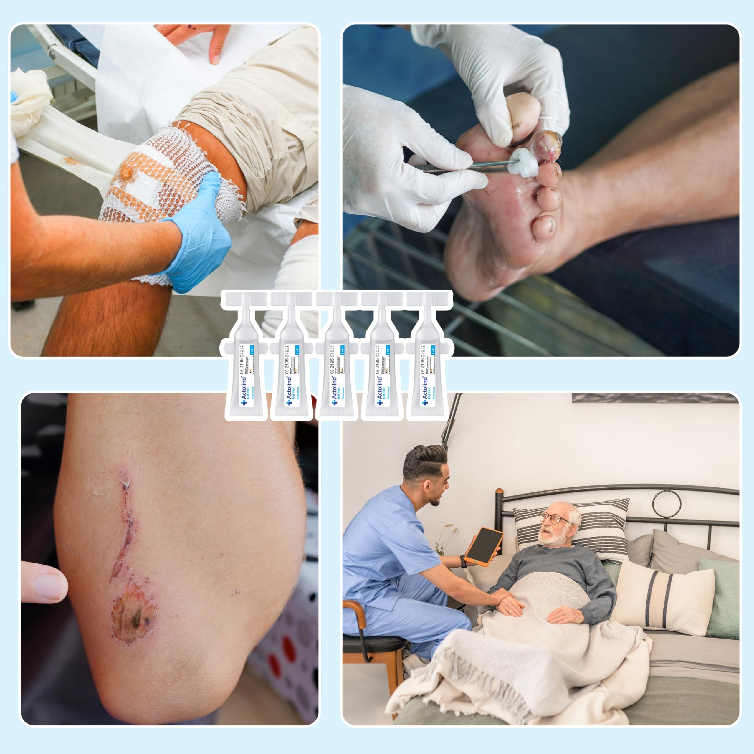 Actolind Gel Plus 25x5 ml – gel antisettico per ferite, indicato per ustioni, punture di insetti e abrasioni, nonché per ferite acute e cronicamente infette. CE III secondo MPG. Con PHMB.