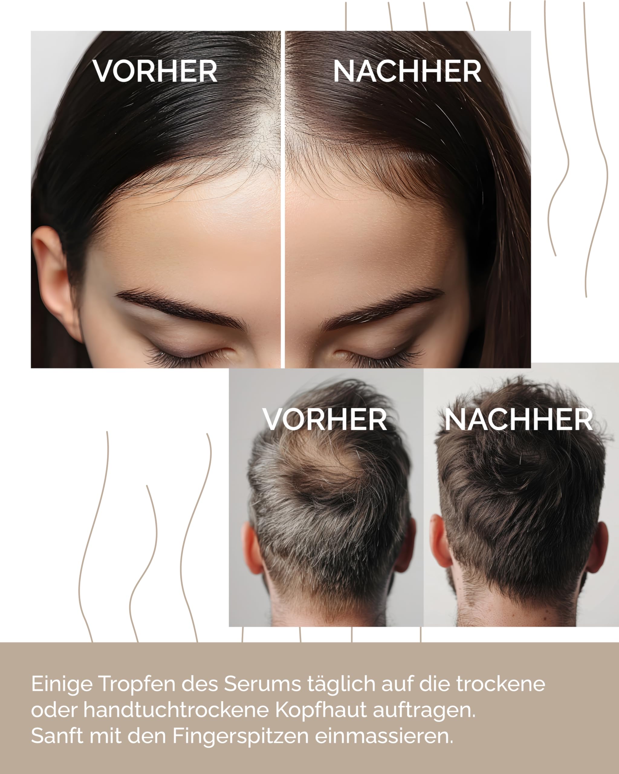 Alpinulin Vibrant Vegation Haar- und Kopfhaut Serum 50ml - 100% vegan, Mit wertvollen Pflanzen-Extrakten, Kupferpeptiden und reinem Alpenquellwasser