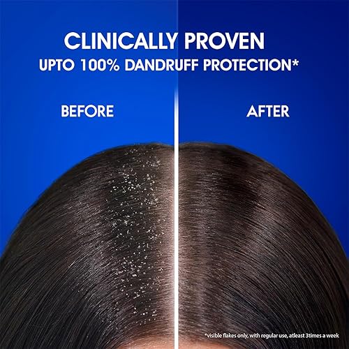 Miniatura 8 de Head & Shoulders Champú anticaspa (Mentol fresco y energiza el cuero cabelludo) - 1L