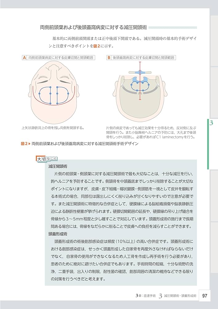 脳神経外科レジデントのためのベーシック手術 | 齋藤竜太 |本 | 通販