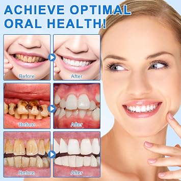 Hydroxyapatite Toothpaste for Enamel Protection & Tooth Strengthening - 9.9% Hydroxyapatite Enamel for Sensitive Teeth to Repair, Fluoride-Free Dental Care with Natural Mint (1 PC)
