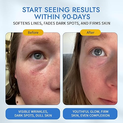 Miniatura 3 de MAELOVE Moonlight Advanced Retinal Super Serum, 10 veces más fuerte que el retinol regular, para suavizar líneas y arrugas, reducir manchas oscuras,