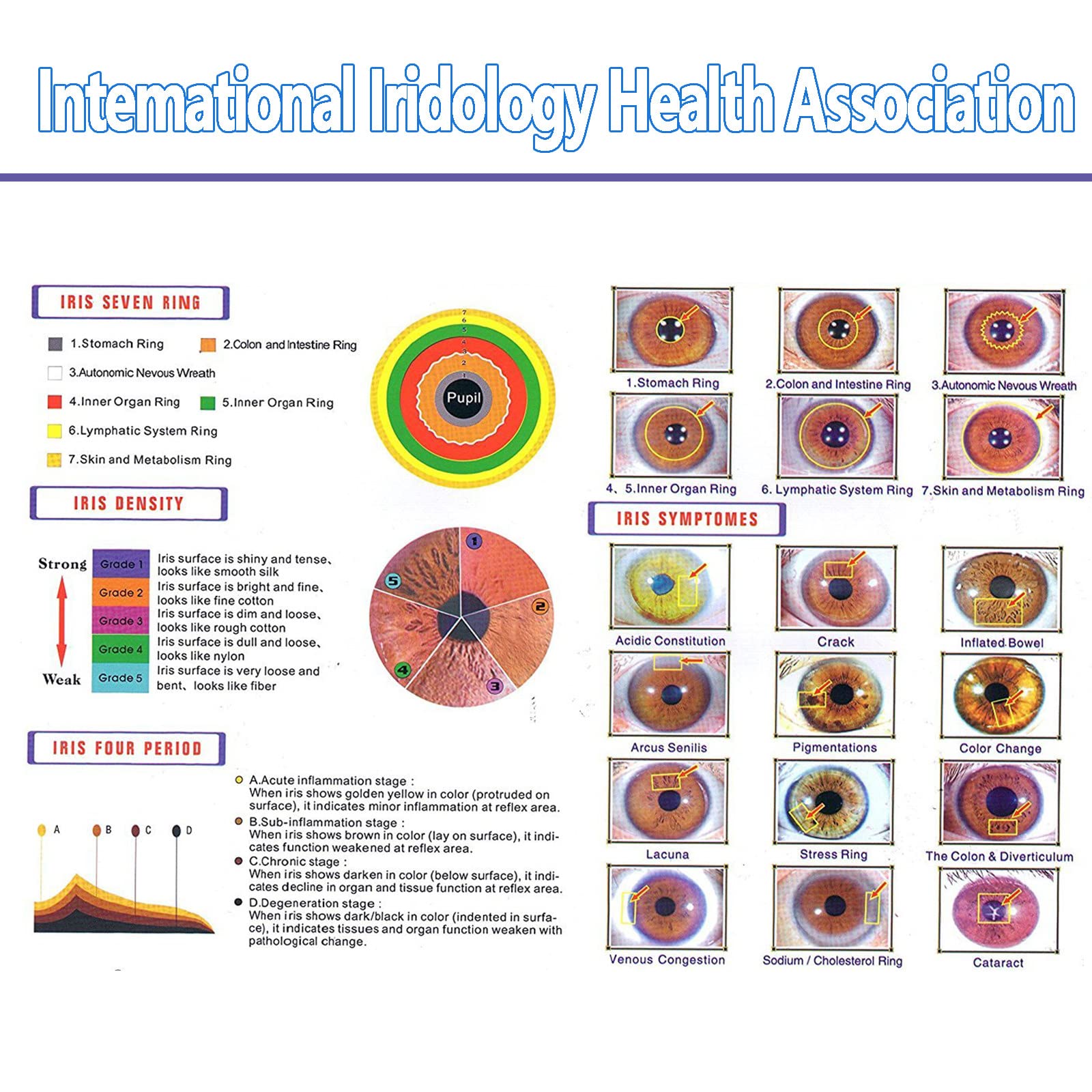 Analizzatore dell'iride Iridologia, Fotocamera per iridologia, Alta Risoluzione USB Iriscope Eye Camera, Iriscope con 30x Iris Lens e Software di Analisi