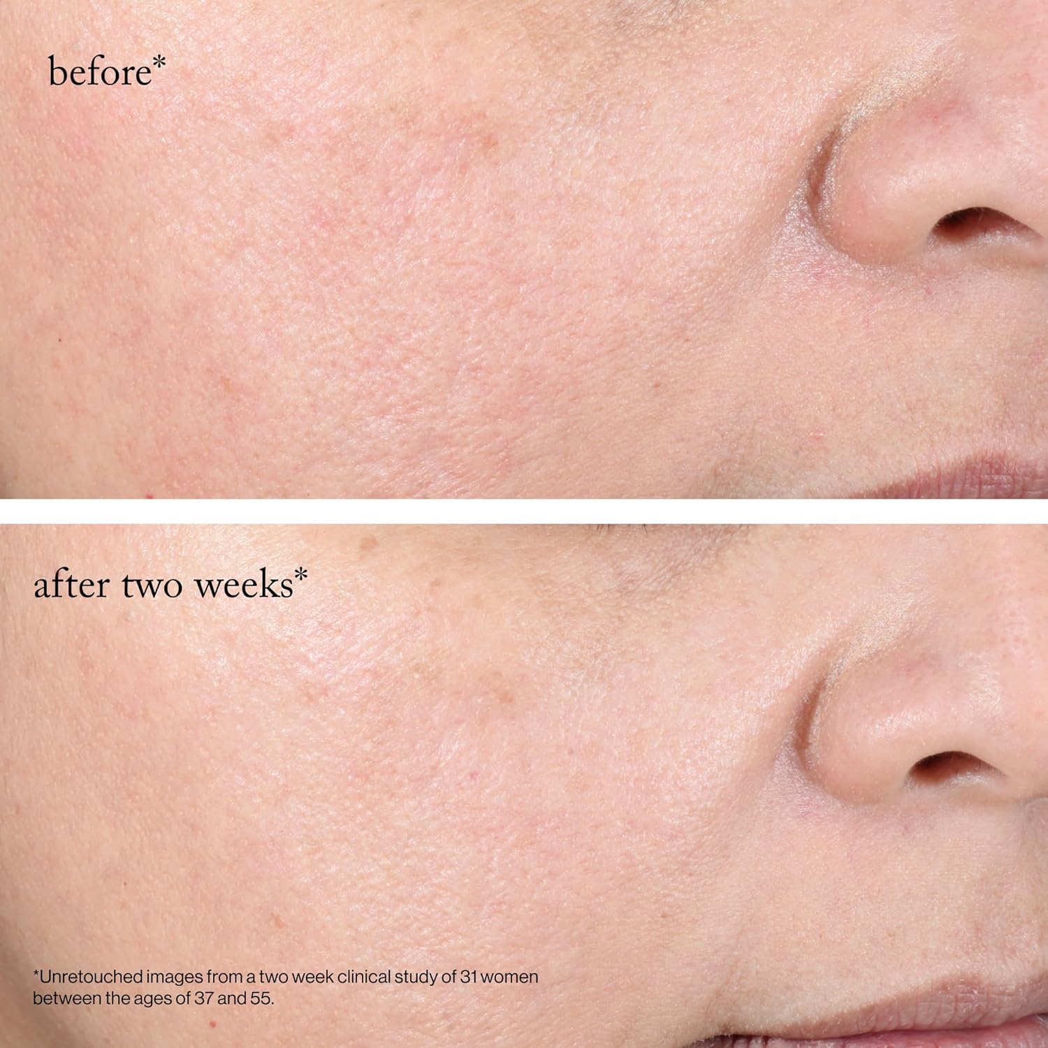 goop Beauty 15% Glycolic Acid Exfoliating Pads | Inspired by a Professional Chemical Peel | Refines & Retexturizes for Glowing Skin | Paraben and Silicone Free | 4 pack - Image 8