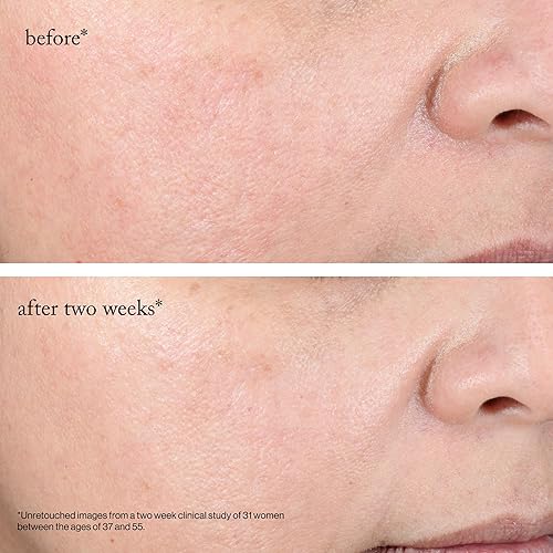 Miniatura 8 de goop Beauty - Almohadillas exfoliantes con ácido glicólico al 15%, inspiradas en un exfoliante químico profesional, refinan y retexturizan para una