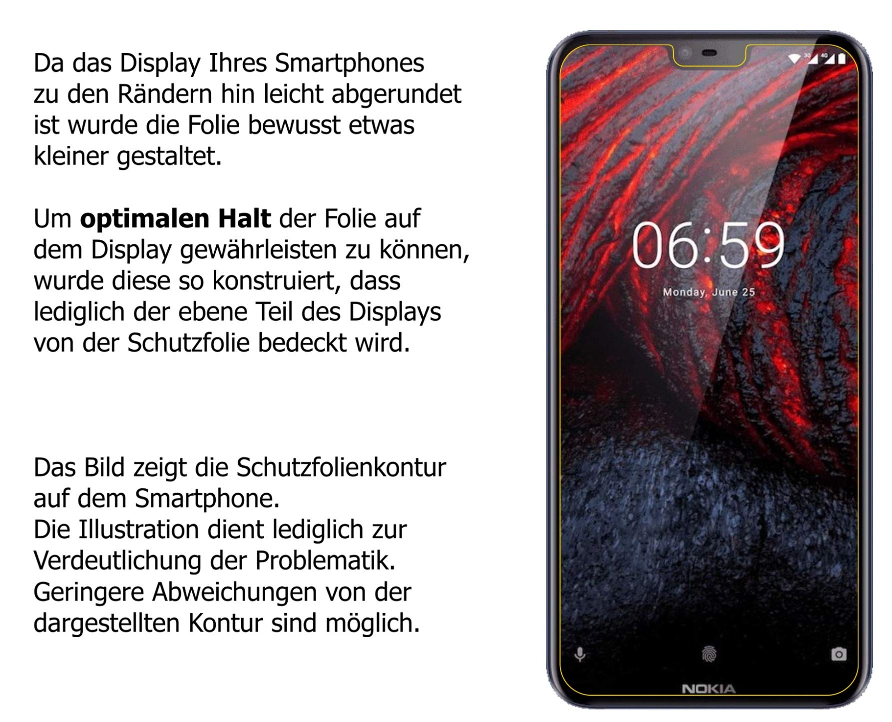 dipos I Protezione a 2 Vie Vista Compatibile con Nokia 6.1