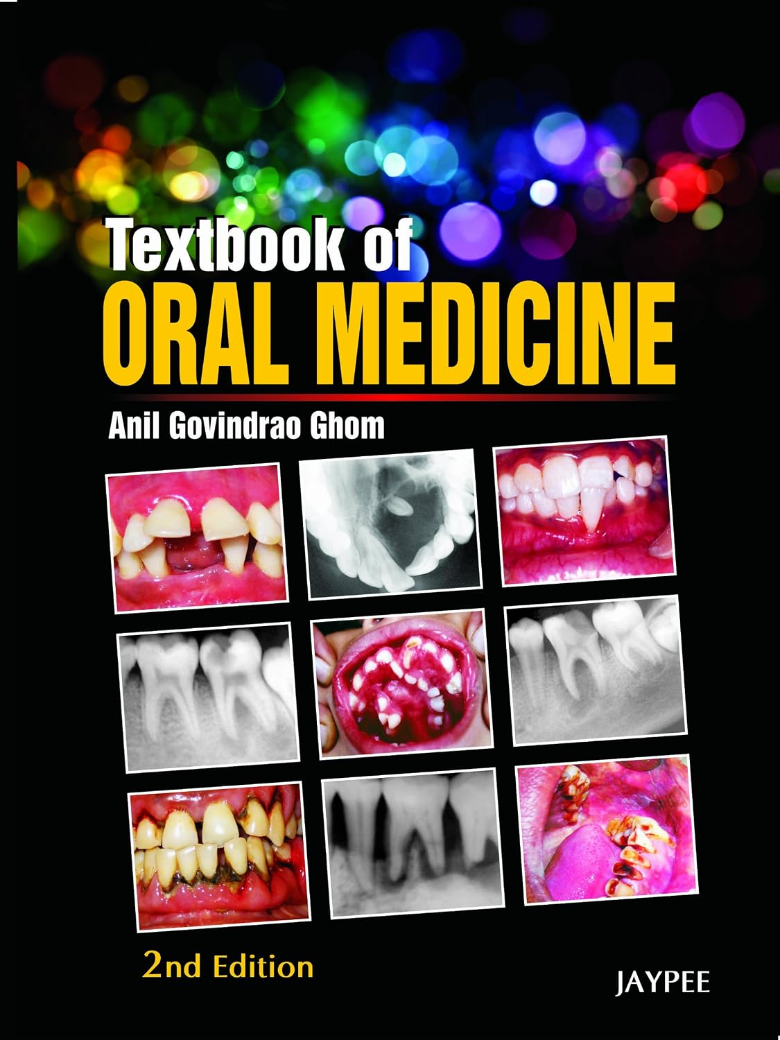 (OLD EDITION) Textbook of Oral Medicine with Free Book on Basic Oral ...