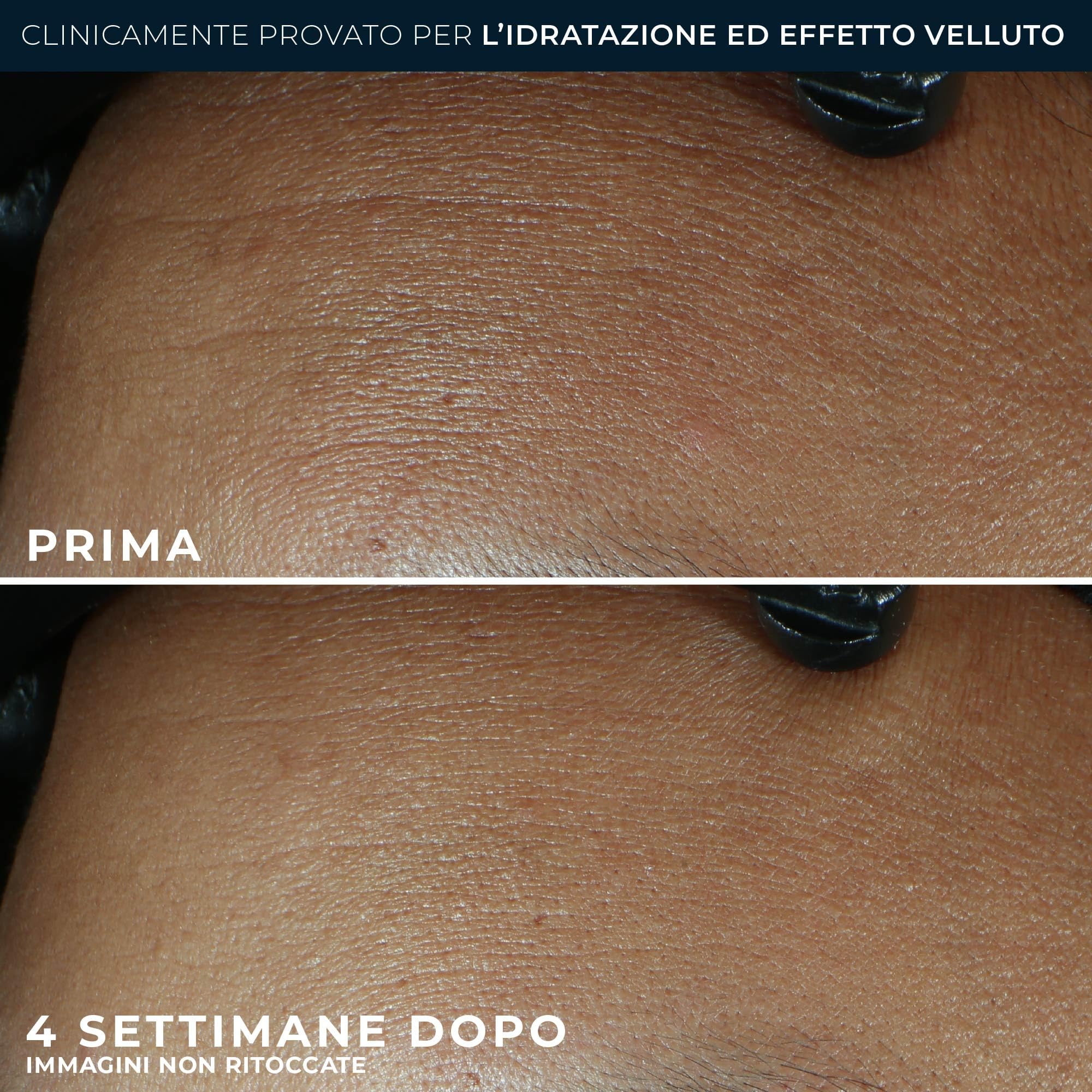 RoC - Retinol Correxion Line Smoothing Idratazione Massima - Trattamento Antirughe Intensivo - Pelle Più Liscia e Luminosa - Acido Ialuronico - 50 ml