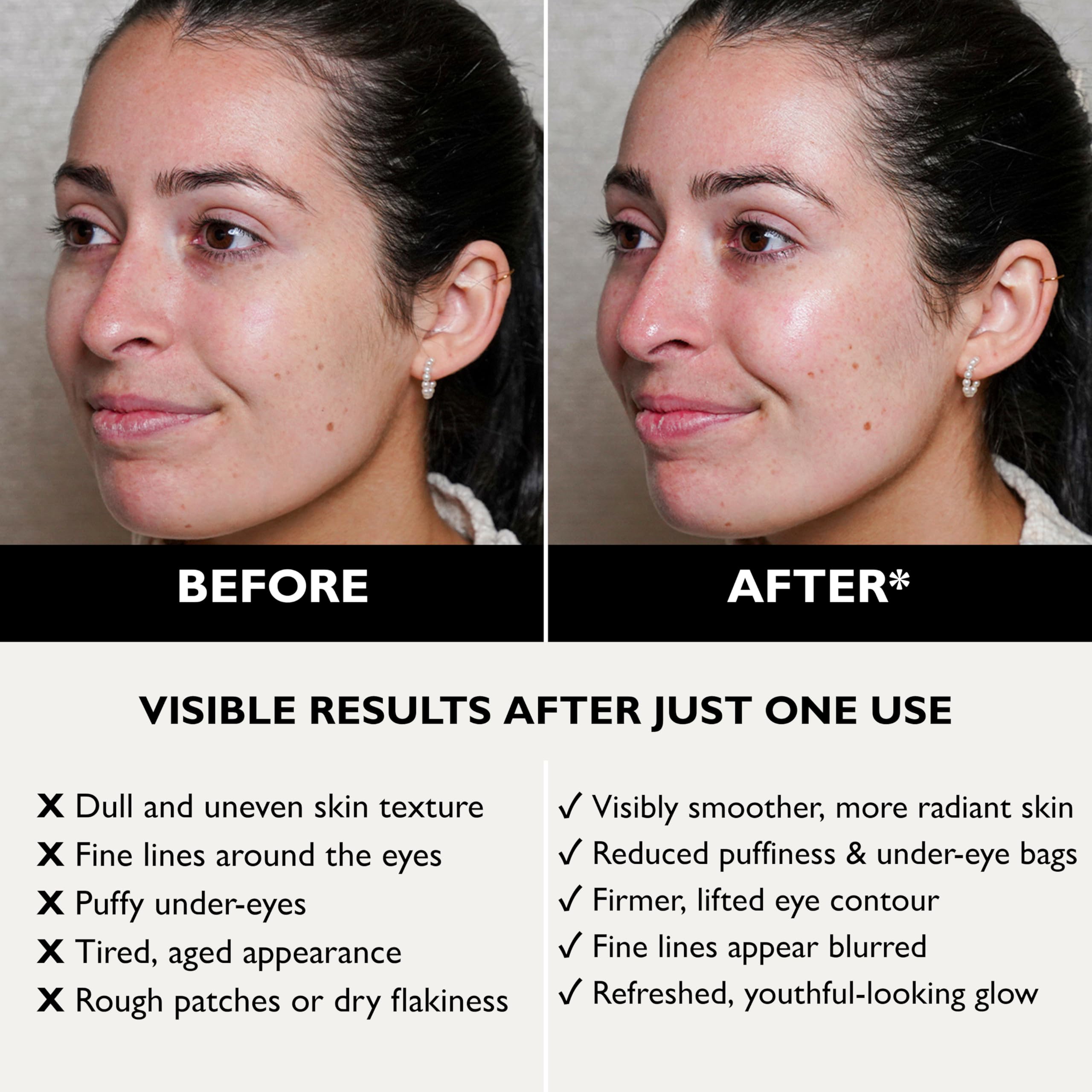 Peter Thomas Roth FIRMx™ Anti-Aging Set – Peeling Gel + Straffendes Gesichtsserum mit Kollagen, Peptiden & Enzymen – Exfolierend & Hautverjüngend – Für reife & müde Haut – 30 ml Serum + Peeling