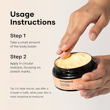 Cureskin Smoothing Body Butter Stretch Marks Cream for Women and Men | Stretch Marks Removal Cream for Women, 100 g (Pack of 1)
