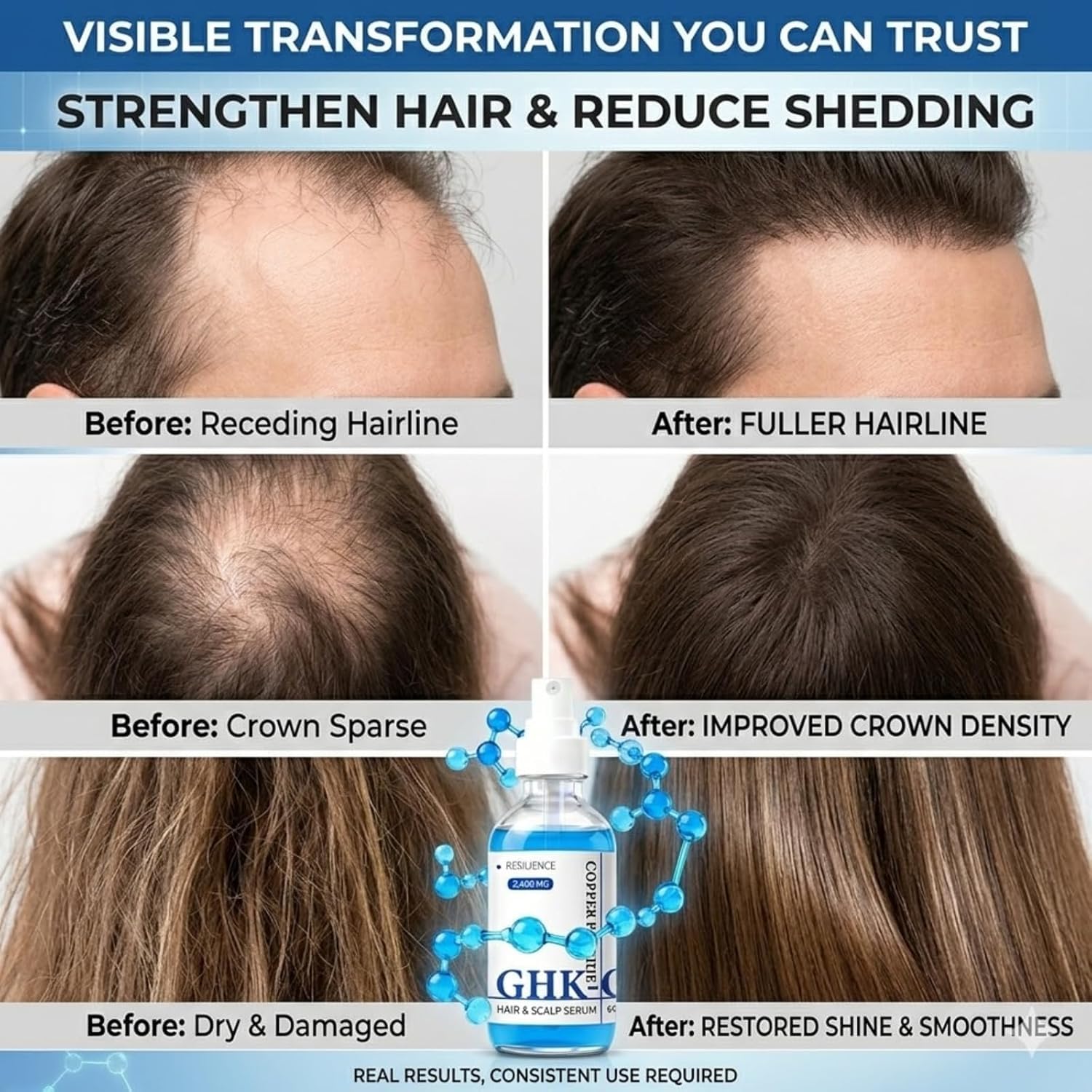 Blue Copper Peptide Hair Serum, GHK-CU Copper Peptide Hair Growth Serum, Strengthens Hair Roots, Reduces Hair Loss, Volumising and Repairing Treatment Beauty