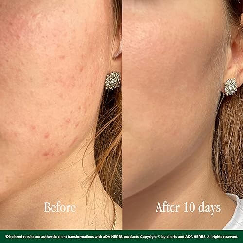 Miniatura 4 de Crema de noche Nightly Bliss con aceite de argán y miel, nutritiva y regeneradora para todo tipo de piel, fabricada en Francia