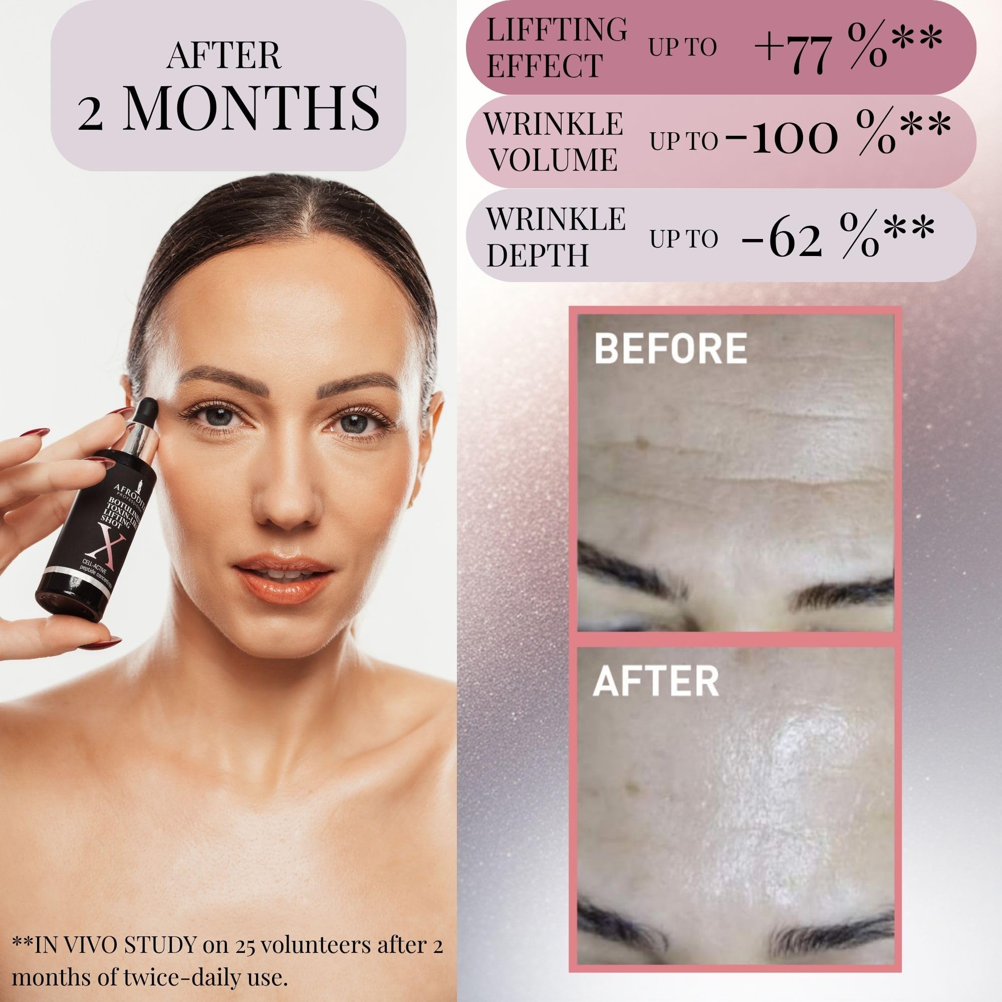 Afrodita Professional Botulinum Toxin-Like X Lifting Shot Peptydowe serum do twarzy przeciw zmarszczkom mimicznym, koncentrat do liftingu dla gładkiej, jędrniejszej skóry, 30 ml