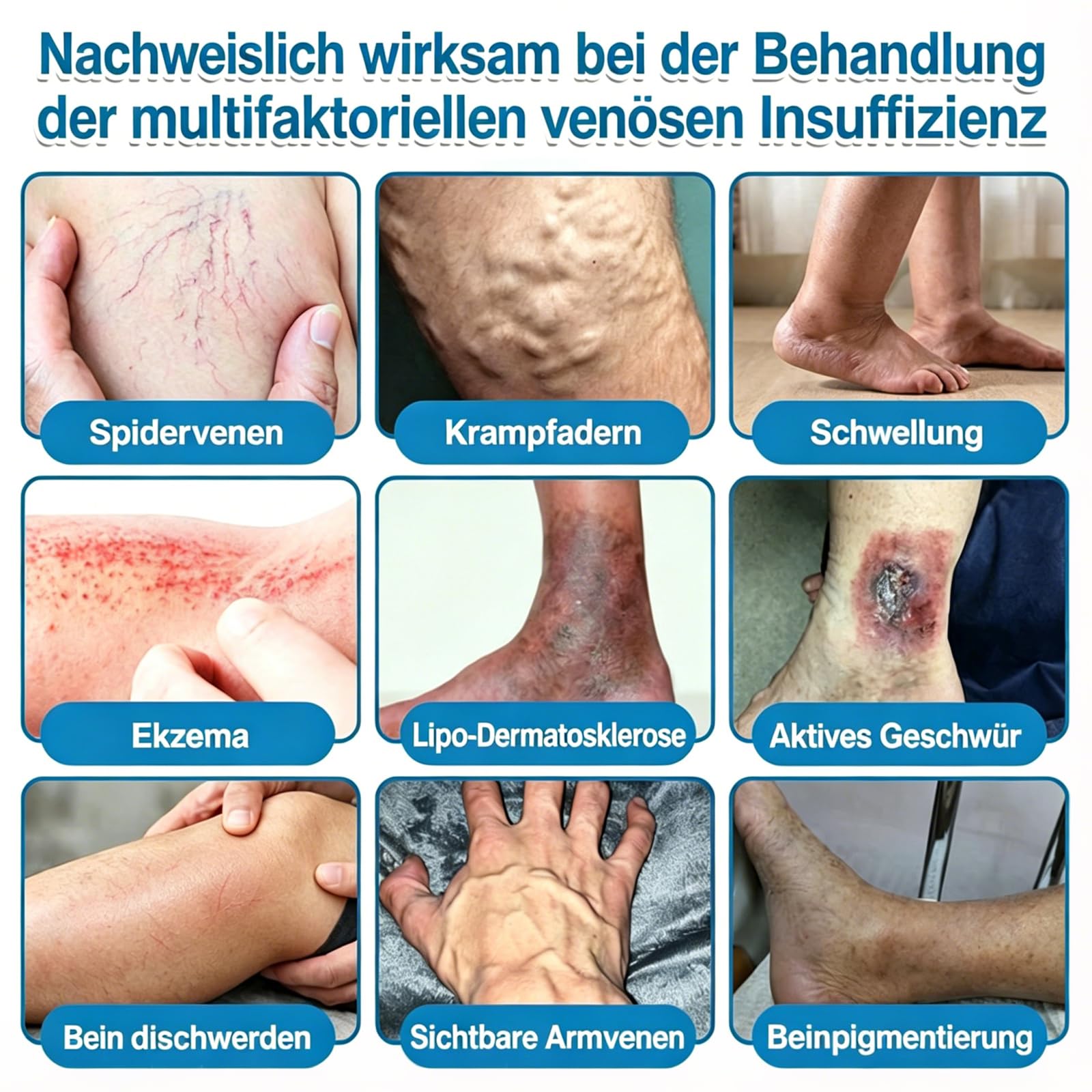 GFOUK VeinRepair Mikronadel Pflasterrolle, GFOUK Mikronadel Pflaster, Professional Vein Heal Pflaster für alle Hauttypen (2PCS)