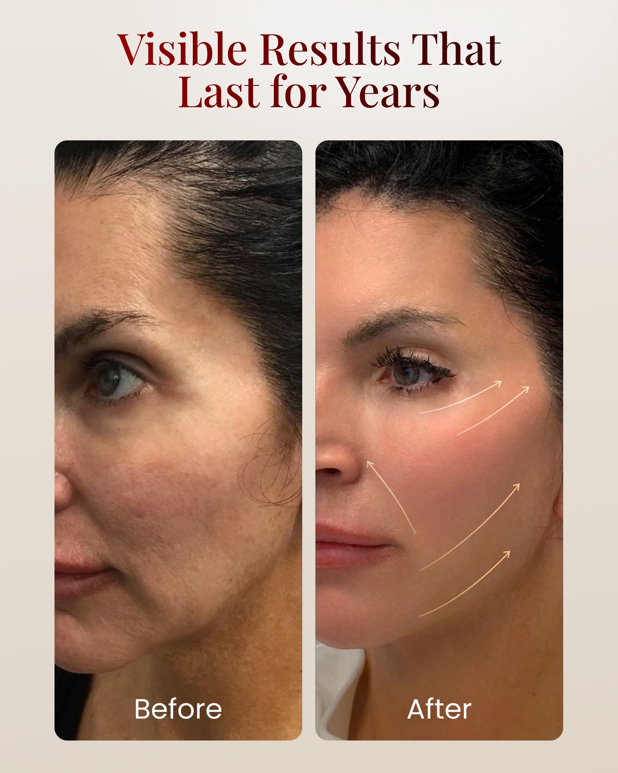 Herramienta de masaje facial, herramienta de escultura facial con terapia de luz LED de 7 colores, dispositivo facial iónico con tratamiento cálido, USB C recargable, caja de regalo +