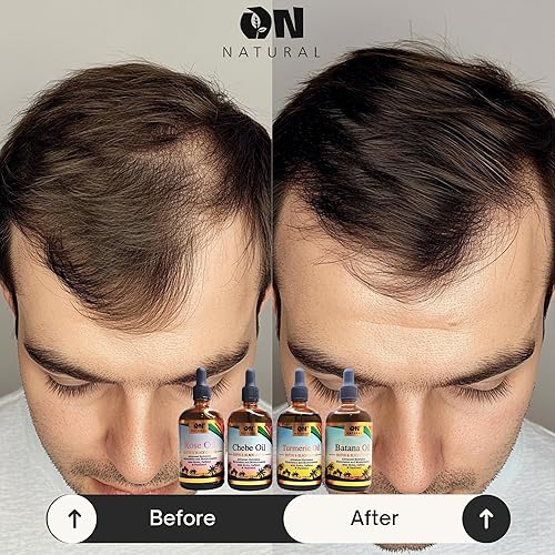 Miniatura 10 de Aceite de ricino negro jamaicano original 4 onzas (coco)