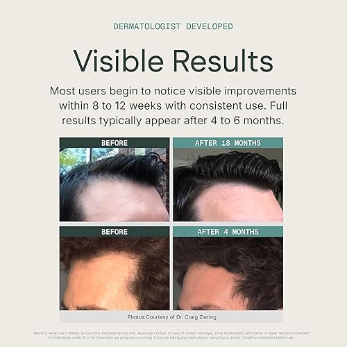 Miniatura 8 de Champú y acondicionador 2 en 1 estimulante del cuero cabelludo, sin medicamentos, sin sulfatos y sin parabenos, factor de crecimiento, fórmula para