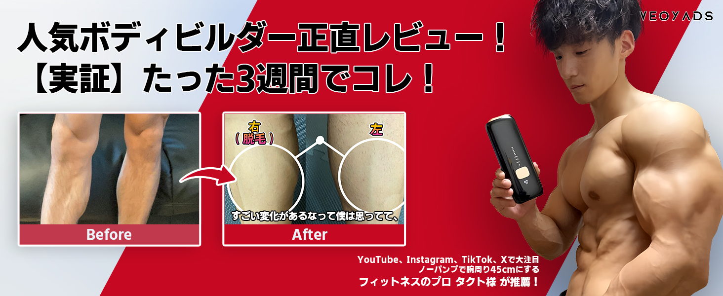 Amazon | CRYSTAL HIPL 光脱毛器 2025夏最新登場 【ドイツのiFデザイン