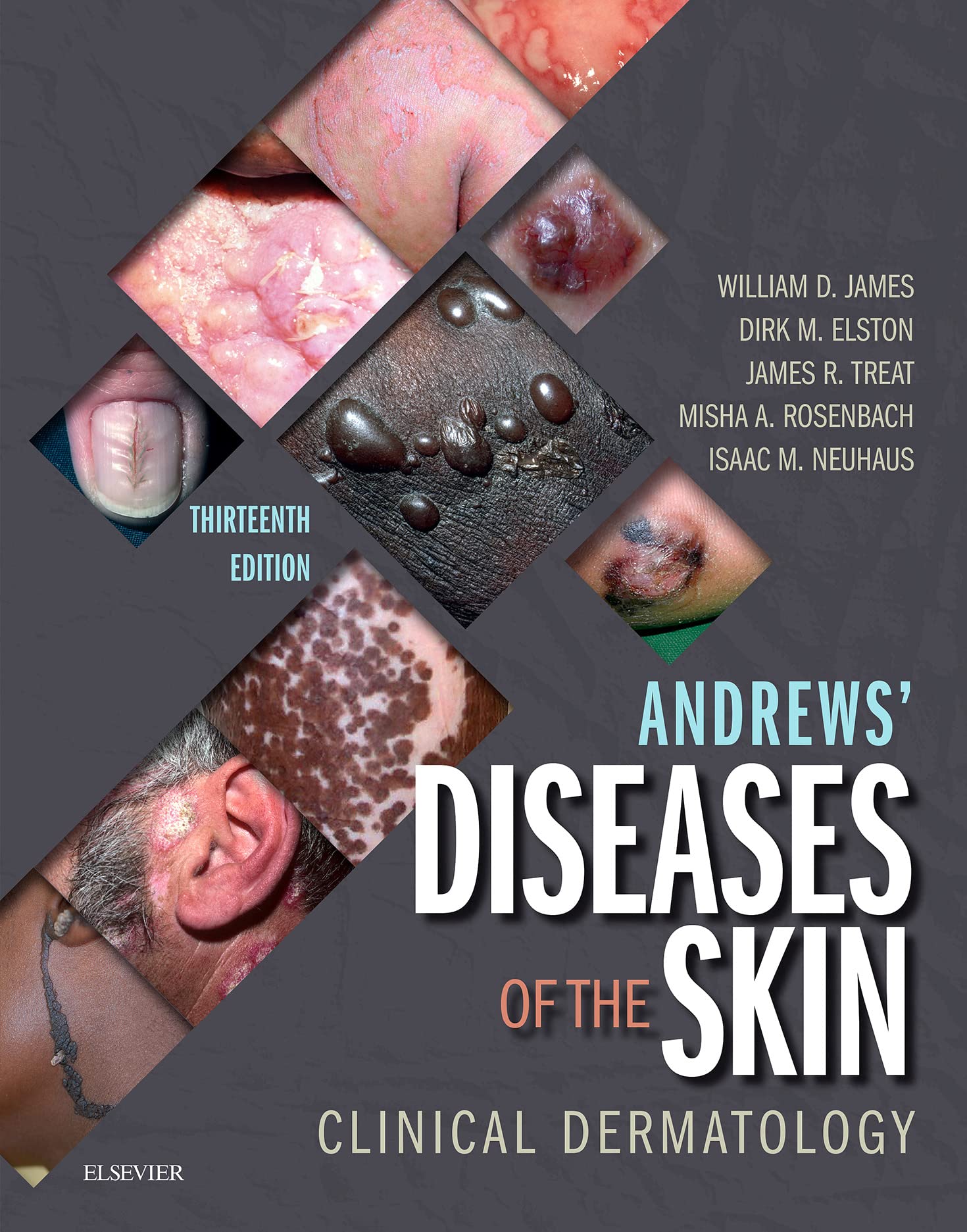 Andrews' Diseases of the Skin: Clinical Dermatology