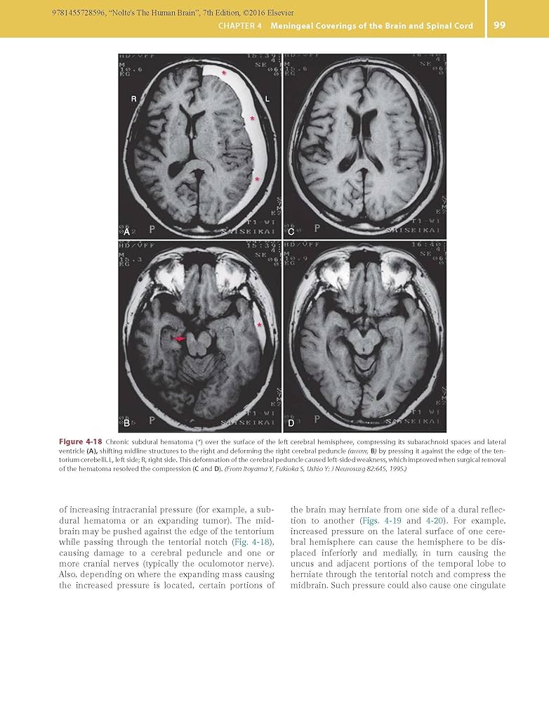 洋書 Duvernoy The Human Brain Second edition 洋書 Duvernoy The Human Brain Second edition 洋書 Duvernoy