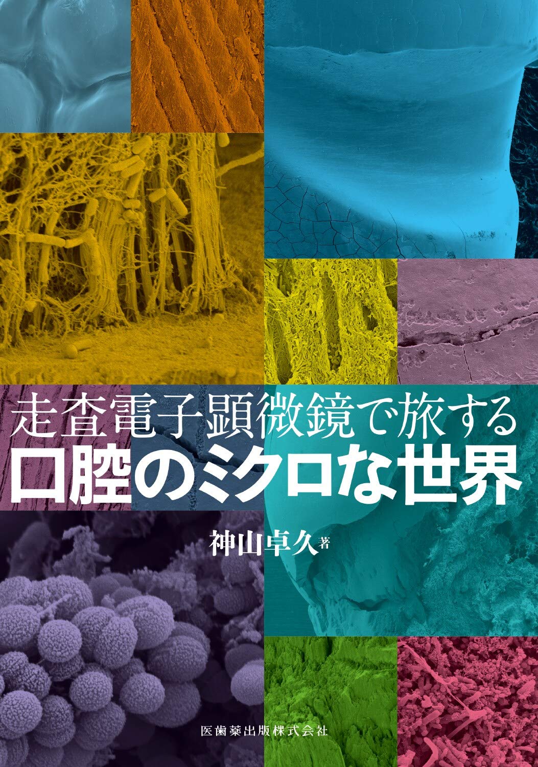 走査電子顕微鏡で旅する口腔のミクロな世界 神山 卓久 本 通販 Amazon