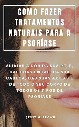 COMO FAZER TRATAMENTOS NATURAIS PARA A PSORÍASE : ALIVIAR A DOR DA SUA PELE, DAS SUAS UNHAS, DA SUA CABEÇA, DAS SUAS AXILAS E DE TODO O SEU CORPO DE TODOS OS TIPOS DE PSORÍASE