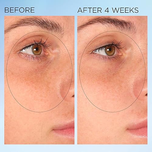 Miniatura 7 de Elizabeth Arden Cápsulas nocturnas de corrección de manchas claramente radiantes que iluminan visiblemente