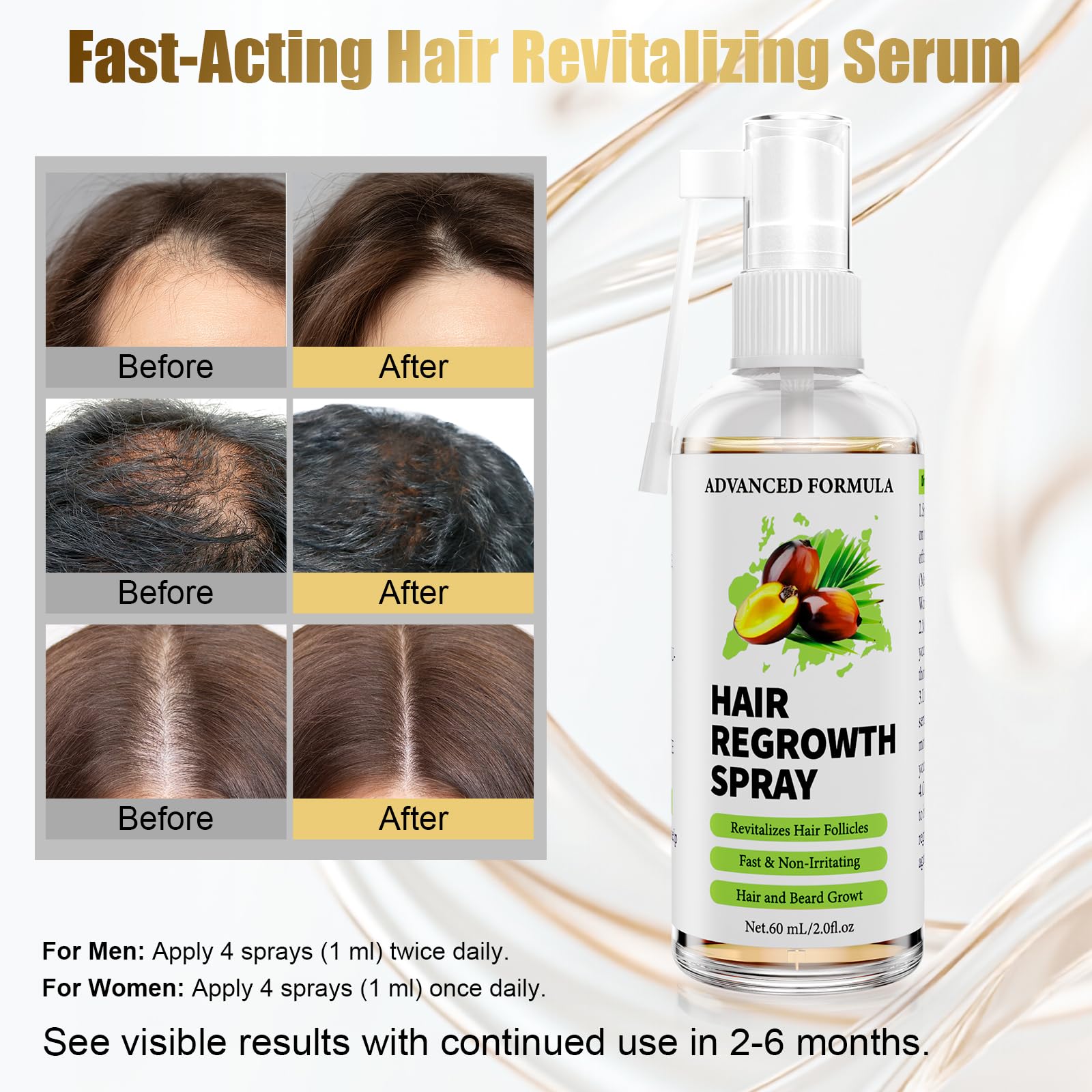 Sérum Crecimiento Cabello Anticaída,con Romero,Batana,60ml | Aceite de Ricino Orgánico&Biotina, para Mujer y Hombre,Fortalece y Mejora la Densidad Capilar,Cuero Cabelludo Sensible,Barba